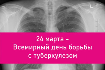  В преддверии Всемирного дня борьбы с туберкулезом краснотурьинцев приглашают пройти флюорографию 